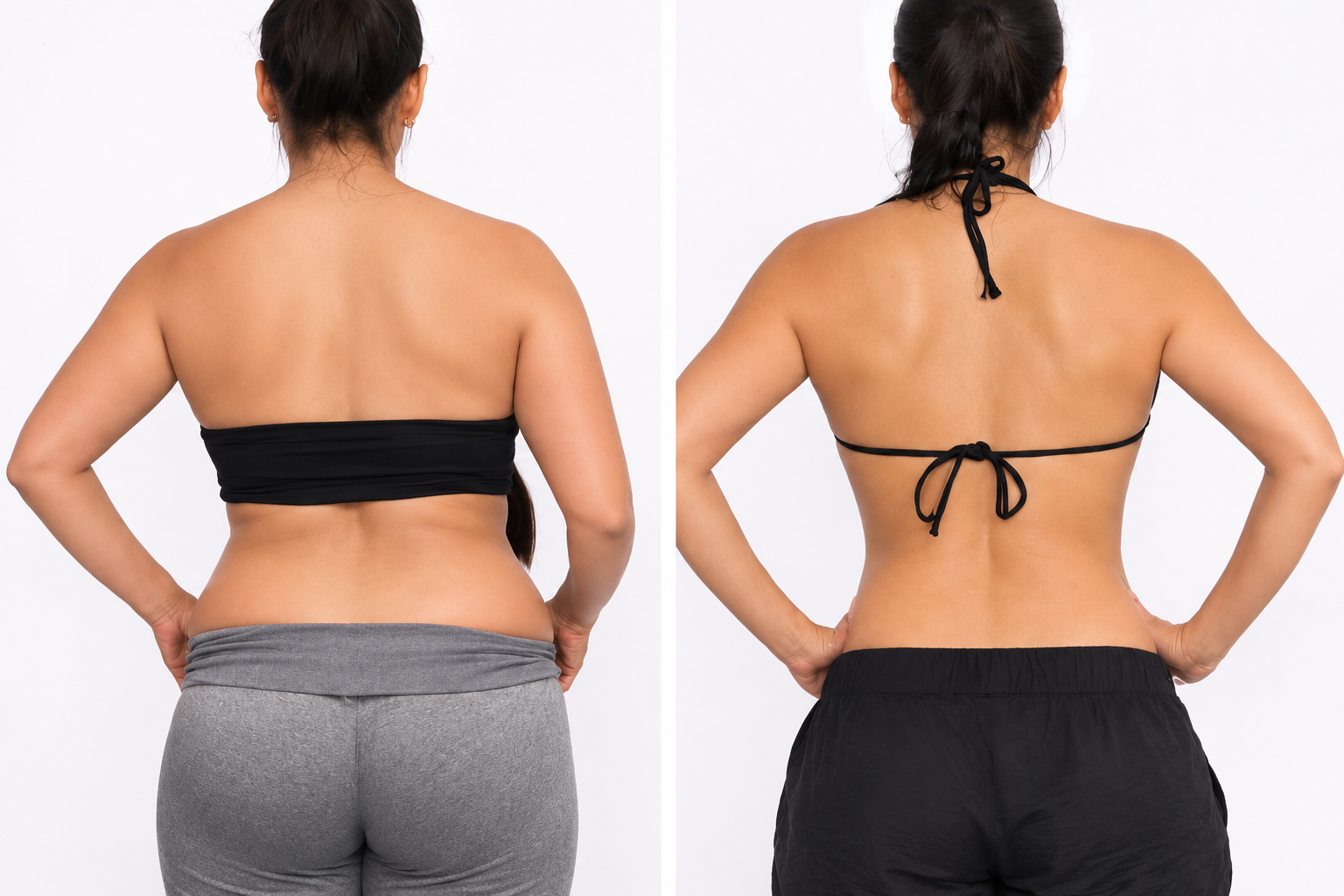 Before and after Sculpting & Body Shaping treatment